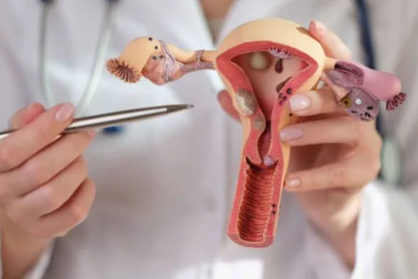 Vaginismus Medical Guidance