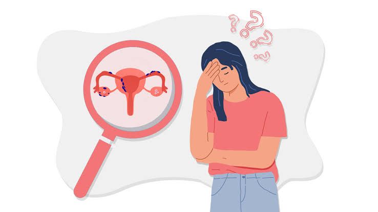 Professional consultation for vaginismus treatment